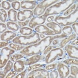 Immunohistochemistry - Anti-DDIT3 Antibody (A89024) - Antibodies.com