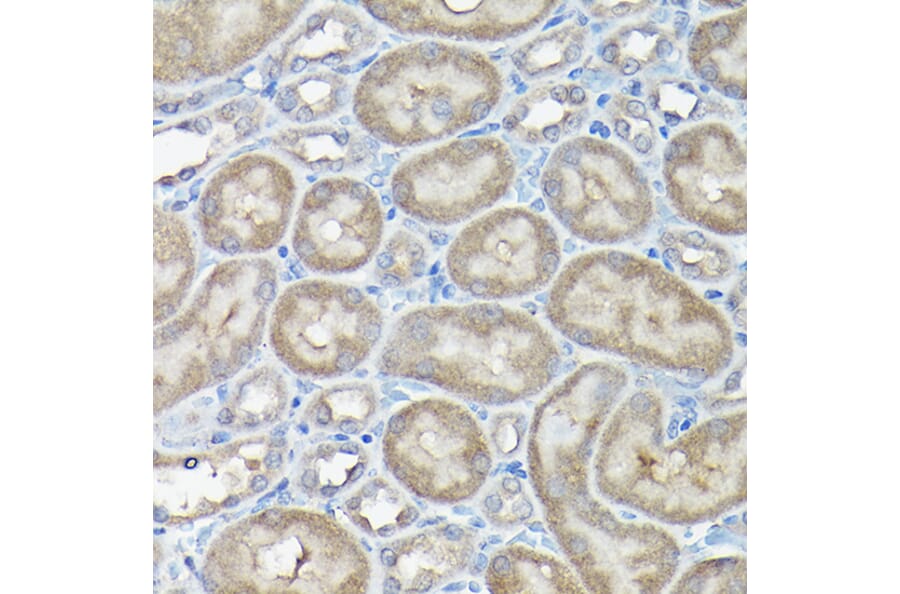 Immunohistochemistry - Anti-DDIT3 Antibody (A89024) - Antibodies.com