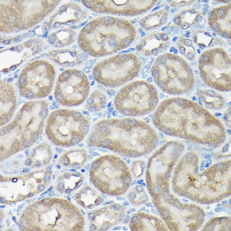 Immunohistochemistry - Anti-DDIT3 Antibody (A89024) - Antibodies.com