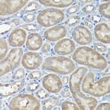 Immunohistochemistry - Anti-DDIT3 Antibody (A89024) - Antibodies.com