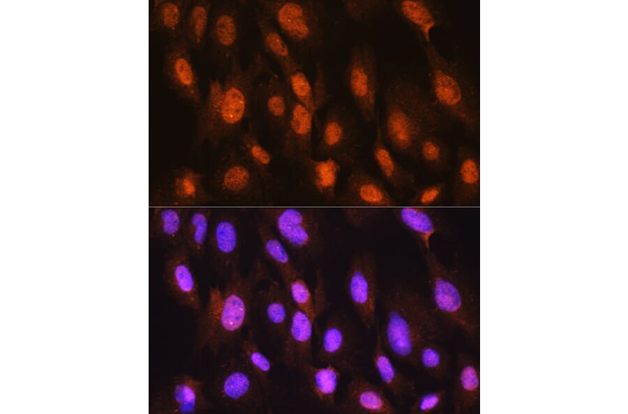 Immunofluorescence - Anti-DDIT3 Antibody (A89024) - Antibodies.com