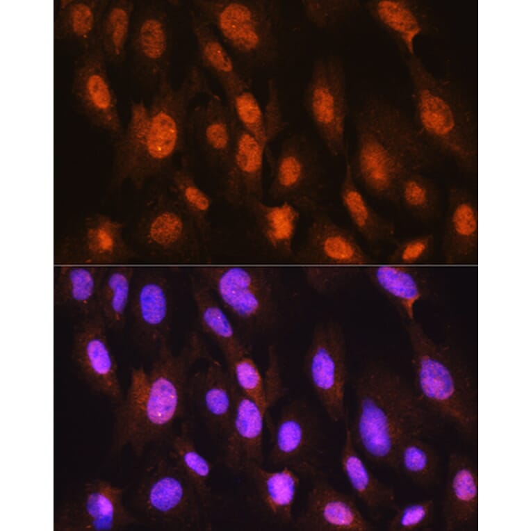 Immunofluorescence - Anti-DDIT3 Antibody (A89024) - Antibodies.com