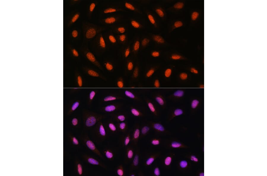 Immunofluorescence - Anti-DDIT3 Antibody (A89024) - Antibodies.com