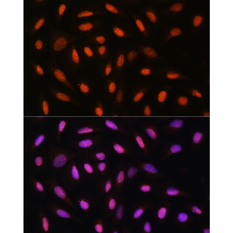 Immunofluorescence - Anti-DDIT3 Antibody (A89024) - Antibodies.com
