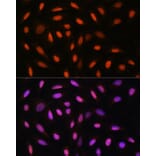 Immunofluorescence - Anti-DDIT3 Antibody (A89024) - Antibodies.com