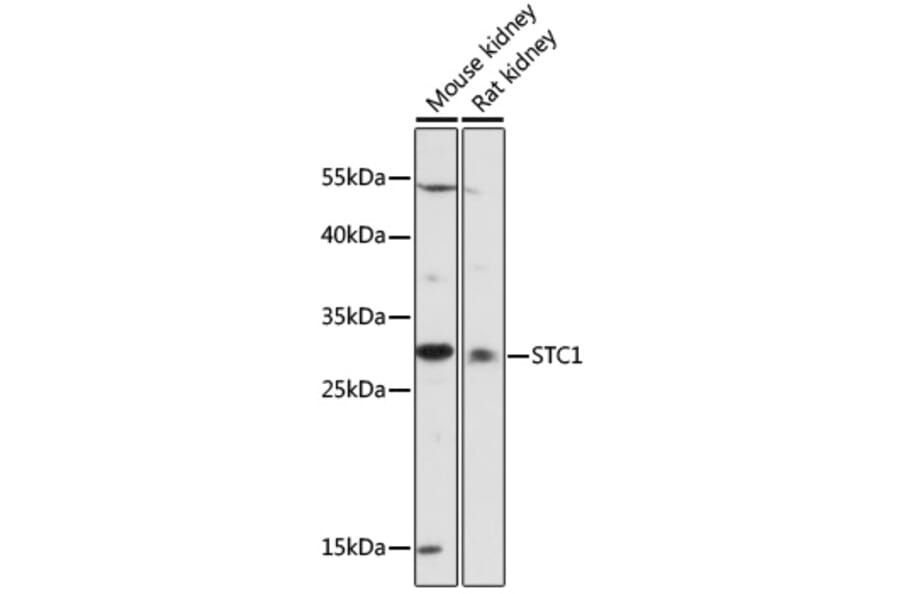 Western Blot - Anti-Stanniocalcin 1/STC Antibody (A89026) - Antibodies.com