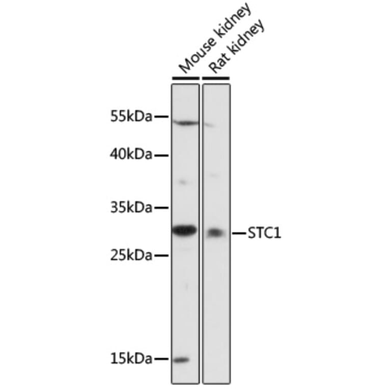Western Blot - Anti-Stanniocalcin 1/STC Antibody (A89026) - Antibodies.com