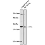 Western Blot - Anti-Stanniocalcin 1/STC Antibody (A89026) - Antibodies.com