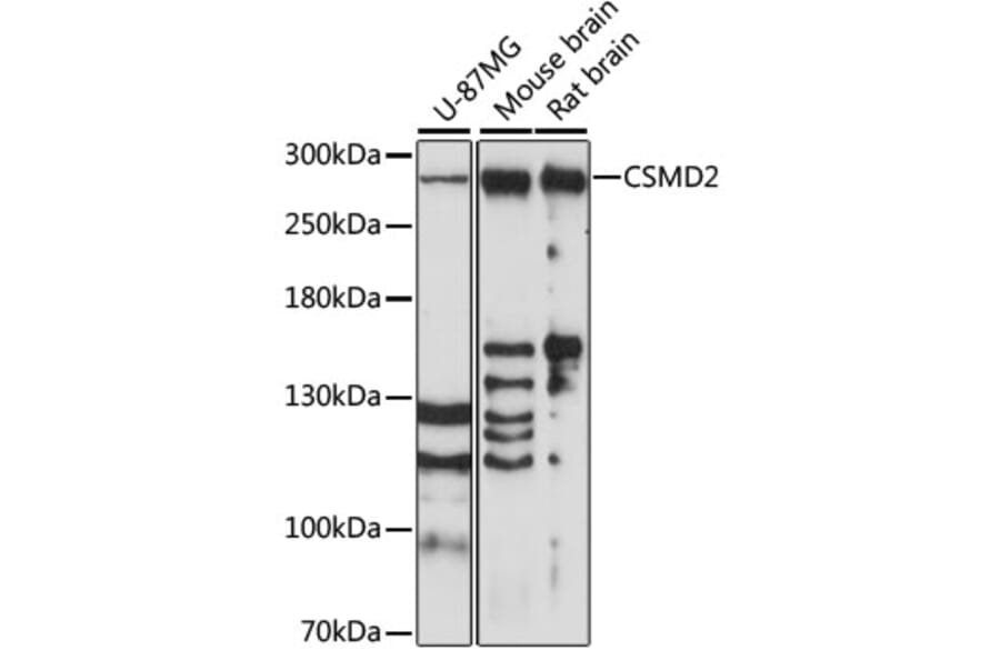 Western Blot - Anti-CSMD2 Antibody (A89028) - Antibodies.com