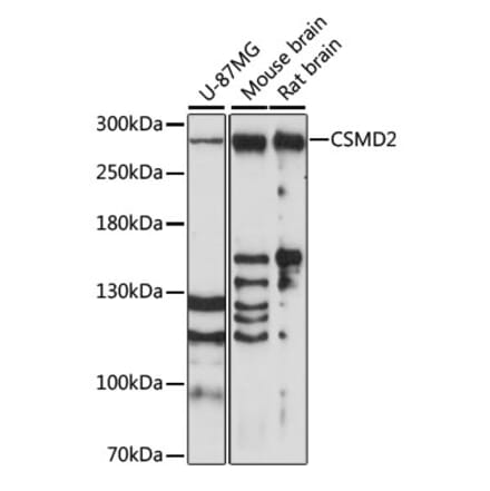 Western Blot - Anti-CSMD2 Antibody (A89028) - Antibodies.com