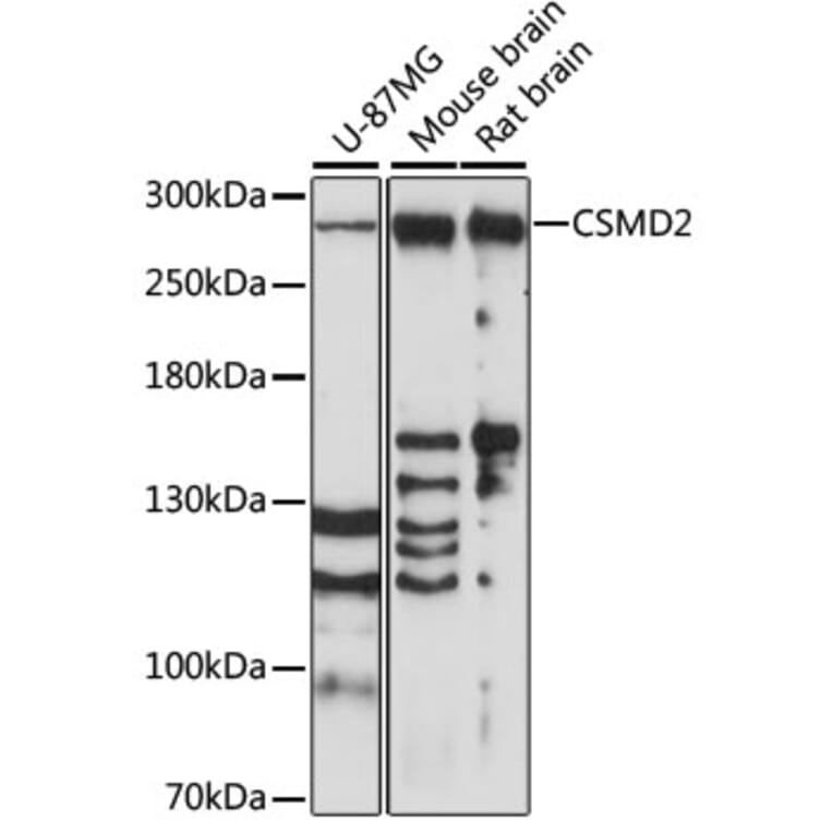 Western Blot - Anti-CSMD2 Antibody (A89028) - Antibodies.com