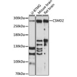 Western Blot - Anti-CSMD2 Antibody (A89028) - Antibodies.com