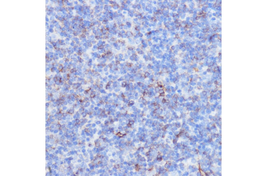 Immunohistochemistry - Anti-NOTCH3 Antibody (A89029) - Antibodies.com