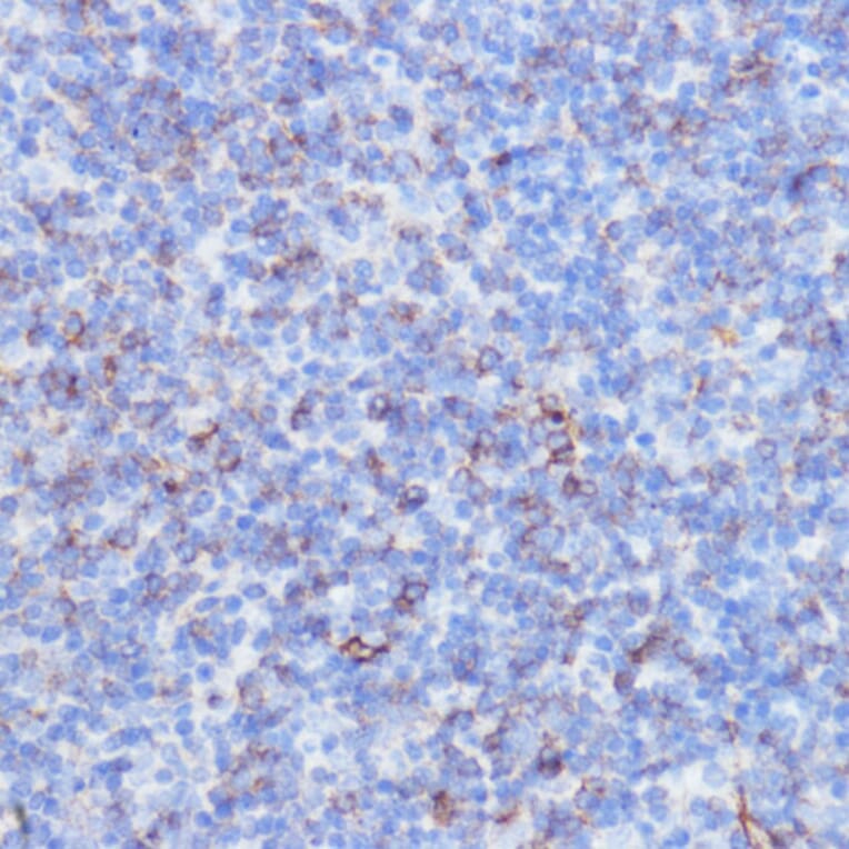 Immunohistochemistry - Anti-NOTCH3 Antibody (A89029) - Antibodies.com