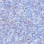Immunohistochemistry - Anti-NOTCH3 Antibody (A89029) - Antibodies.com