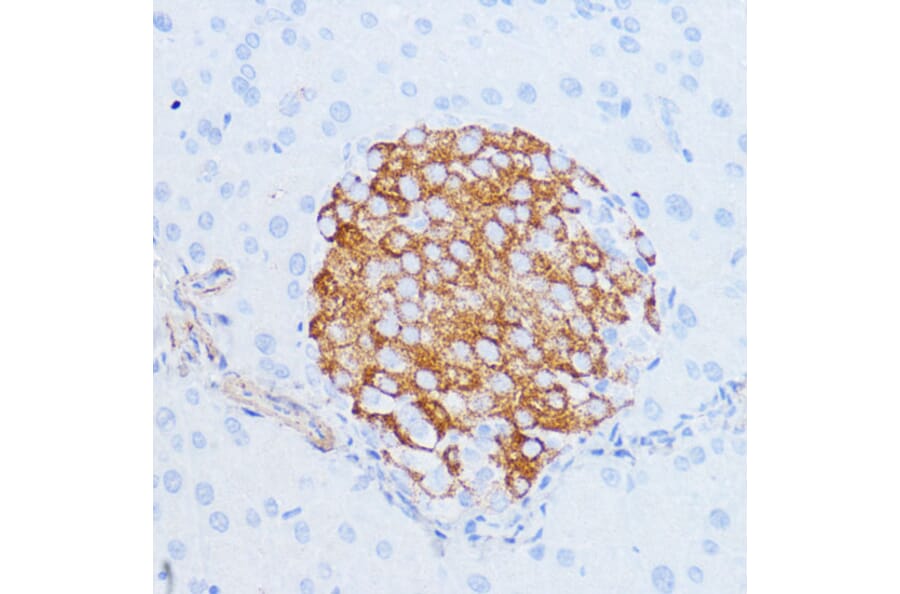 Immunohistochemistry - Anti-NOTCH3 Antibody (A89029) - Antibodies.com