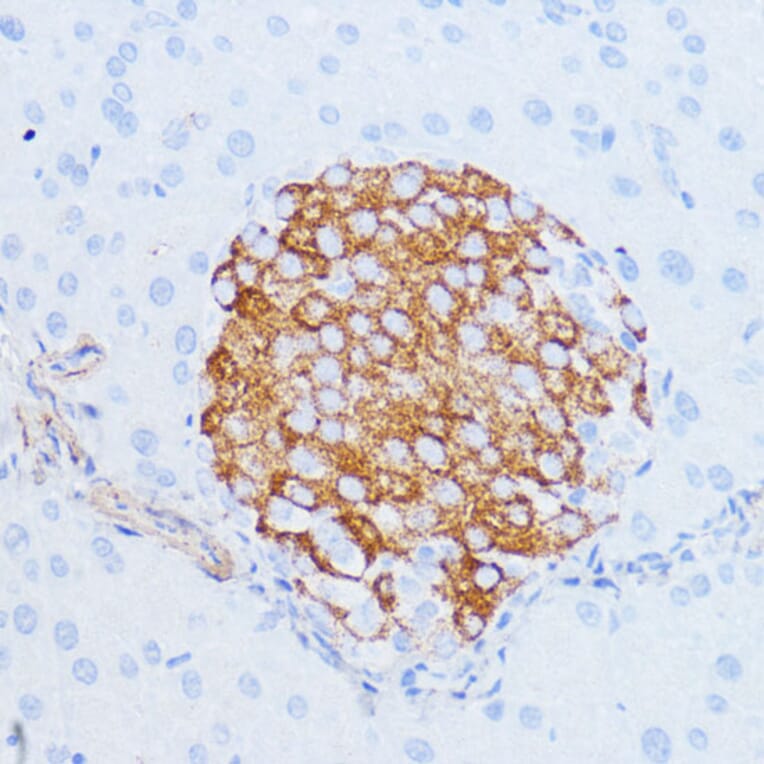 Immunohistochemistry - Anti-NOTCH3 Antibody (A89029) - Antibodies.com