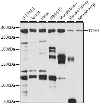 Western blot analysis of extracts of various cell lines, using Anti-TCHH Antibody (A15731) at 1:1,000 dilution.
Secondary antibody: Goat Anti-Rabbit IgG (H+L) (HRP) (AS014) at 1:10,000 dilution.
Lysates / proteins: 25µg per lane.
Blocking buffer: 3% non-fat dry milk in TBST.
Detection: ECL Basic Kit (RM00020).
Exposure time: 60s.