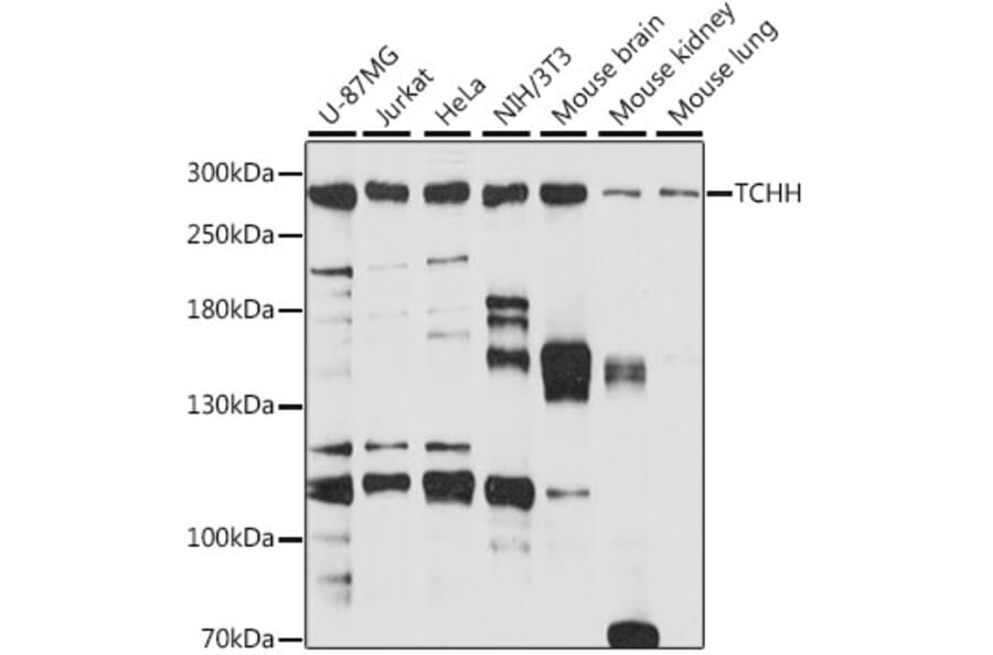 Western Blot - Anti-Trichohyalin Antibody (A89030) - Antibodies.com