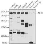 Western Blot - Anti-Trichohyalin Antibody (A89030) - Antibodies.com