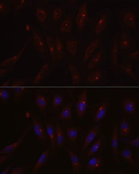 Immunofluorescence analysis of HeLa cells using Anti-PCM1 Antibody (A16637). Blue: DAPI for nuclear staining.