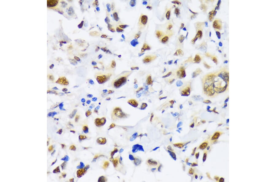 Immunohistochemistry - Anti-KAT3B/p300 Antibody (A89032) - Antibodies.com