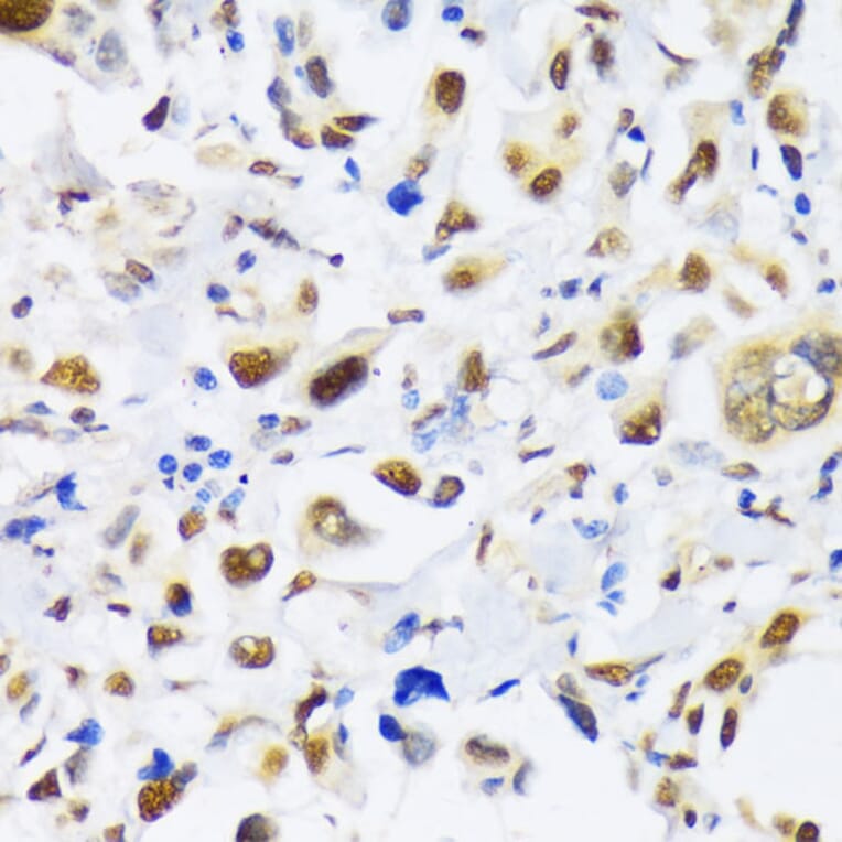 Immunohistochemistry - Anti-KAT3B/p300 Antibody (A89032) - Antibodies.com