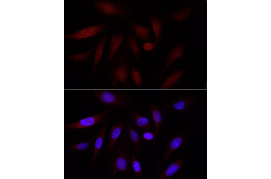 Immunofluorescence - Anti-KAT3B/p300 Antibody (A89032) - Antibodies.com