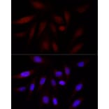 Immunofluorescence - Anti-KAT3B/p300 Antibody (A89032) - Antibodies.com