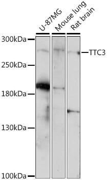 Western blot analysis of extracts of various cell lines, using Anti-TTC3 Antibody (A15734) at 1:1,000 dilution.
Secondary antibody: Goat Anti-Rabbit IgG (H+L) (HRP) (AS014) at 1:10,000 dilution.
Lysates / proteins: 25µg per lane.
Blocking buffer: 3% non-fat dry milk in TBST.
Detection: ECL Enhanced Kit (RM00021).
Exposure time: 3min.
