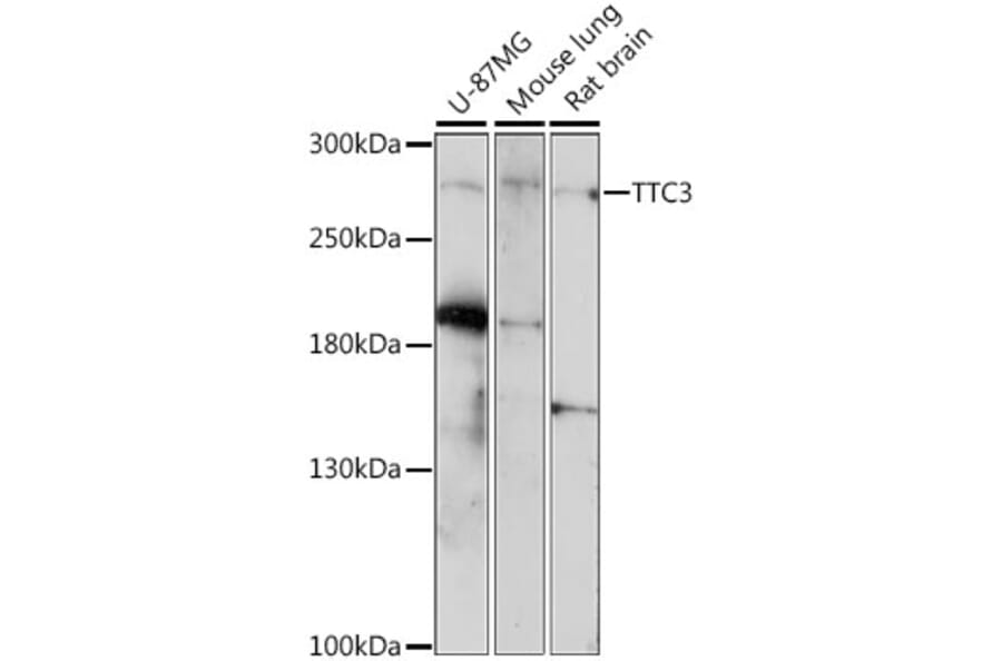 Western Blot - Anti-TTC3 Antibody (A89033) - Antibodies.com