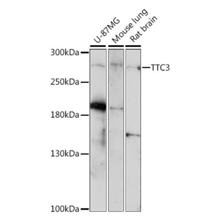 Western Blot - Anti-TTC3 Antibody (A89033) - Antibodies.com