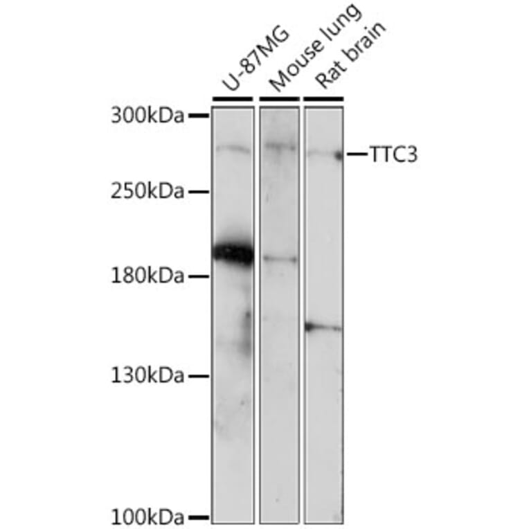 Western Blot - Anti-TTC3 Antibody (A89033) - Antibodies.com