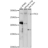 Western Blot - Anti-TTC3 Antibody (A89033) - Antibodies.com