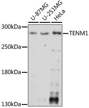 Western blot analysis of extracts of various cell lines, using Anti-TENM1 Antibody (A15774) at 1:1,000 dilution.
Secondary antibody: Goat Anti-Rabbit IgG (H+L) (HRP) (AS014) at 1:10,000 dilution.
Lysates / proteins: 25µg per lane.
Blocking buffer: 3% non-fat dry milk in TBST.
Detection: ECL Basic Kit (RM00020).
Exposure time: 30s.