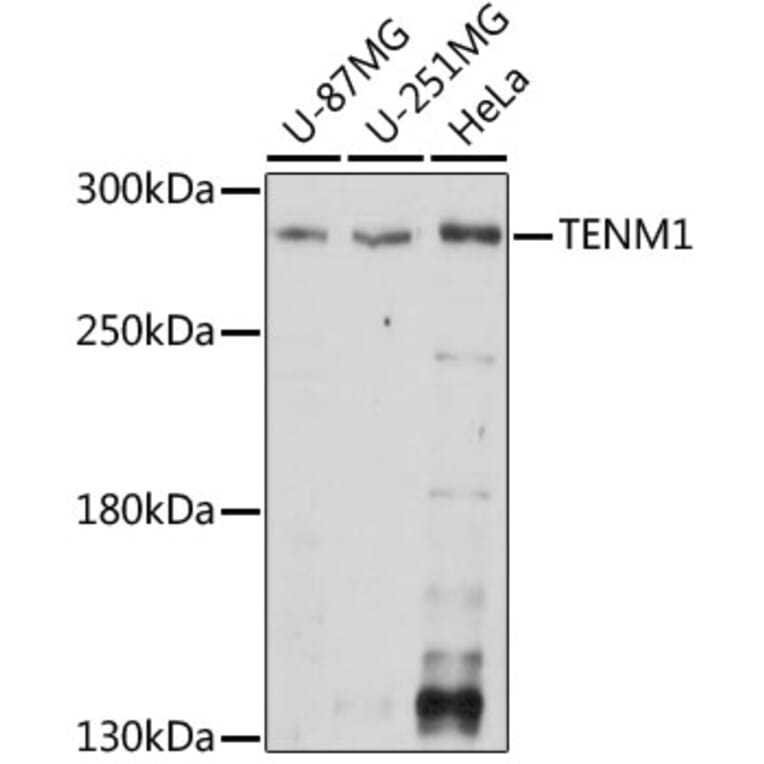 Western Blot - Anti-Ten-1 Antibody (A89034) - Antibodies.com