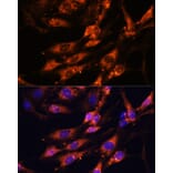 Immunofluorescence - Anti-Ten-1 Antibody (A89034) - Antibodies.com