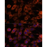 Immunofluorescence - Anti-Ten-1 Antibody (A89034) - Antibodies.com