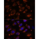 Immunofluorescence - Anti-Ten-1 Antibody (A89034) - Antibodies.com