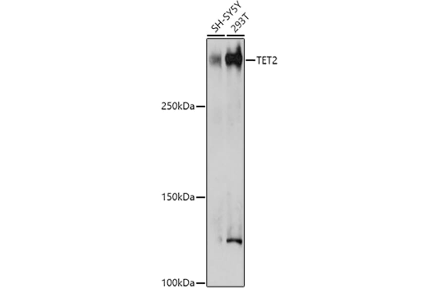 Western Blot - Anti-Tet2 Antibody (A89035) - Antibodies.com