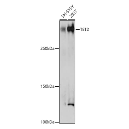 Western Blot - Anti-Tet2 Antibody (A89035) - Antibodies.com