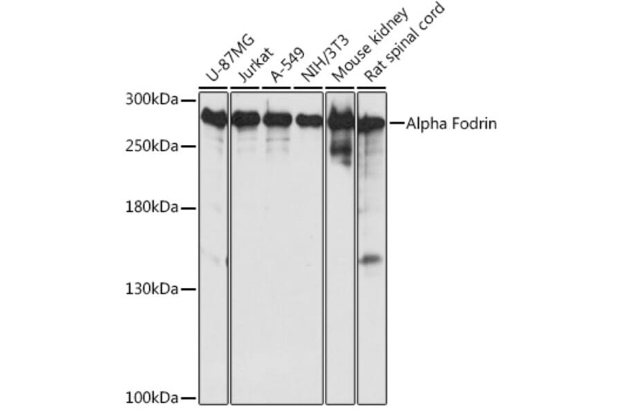 Western Blot - Anti-NEAS Antibody (A89037) - Antibodies.com