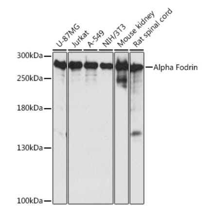 Western Blot - Anti-NEAS Antibody (A89037) - Antibodies.com