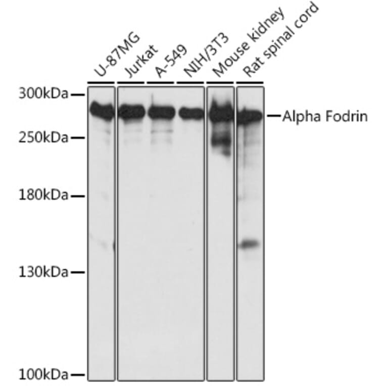Western Blot - Anti-NEAS Antibody (A89037) - Antibodies.com