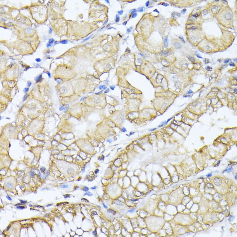 Immunohistochemistry - Anti-NEAS Antibody (A89037) - Antibodies.com