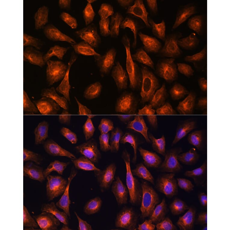 Immunofluorescence - Anti-NEAS Antibody (A89037) - Antibodies.com