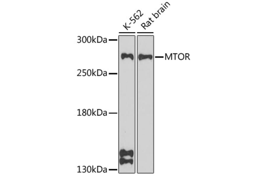 Western Blot - Anti-mTOR Antibody (A11345) - Antibodies.com