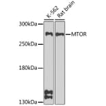 Western Blot - Anti-mTOR Antibody (A11345) - Antibodies.com