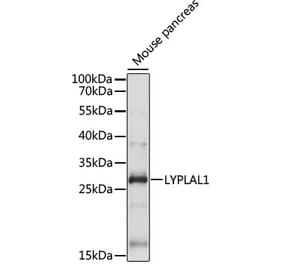 Western Blot - Anti-LYPLAL1 Antibody (A89040) - Antibodies.com