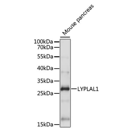 Western Blot - Anti-LYPLAL1 Antibody (A89040) - Antibodies.com